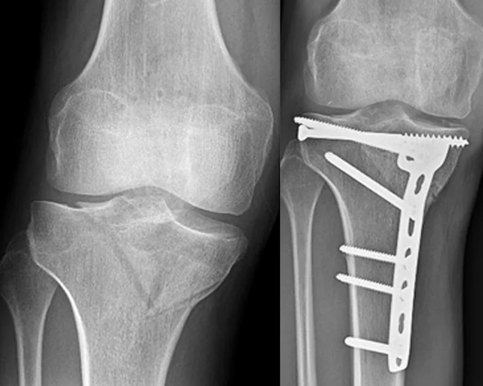 Chirurgie orthopédique