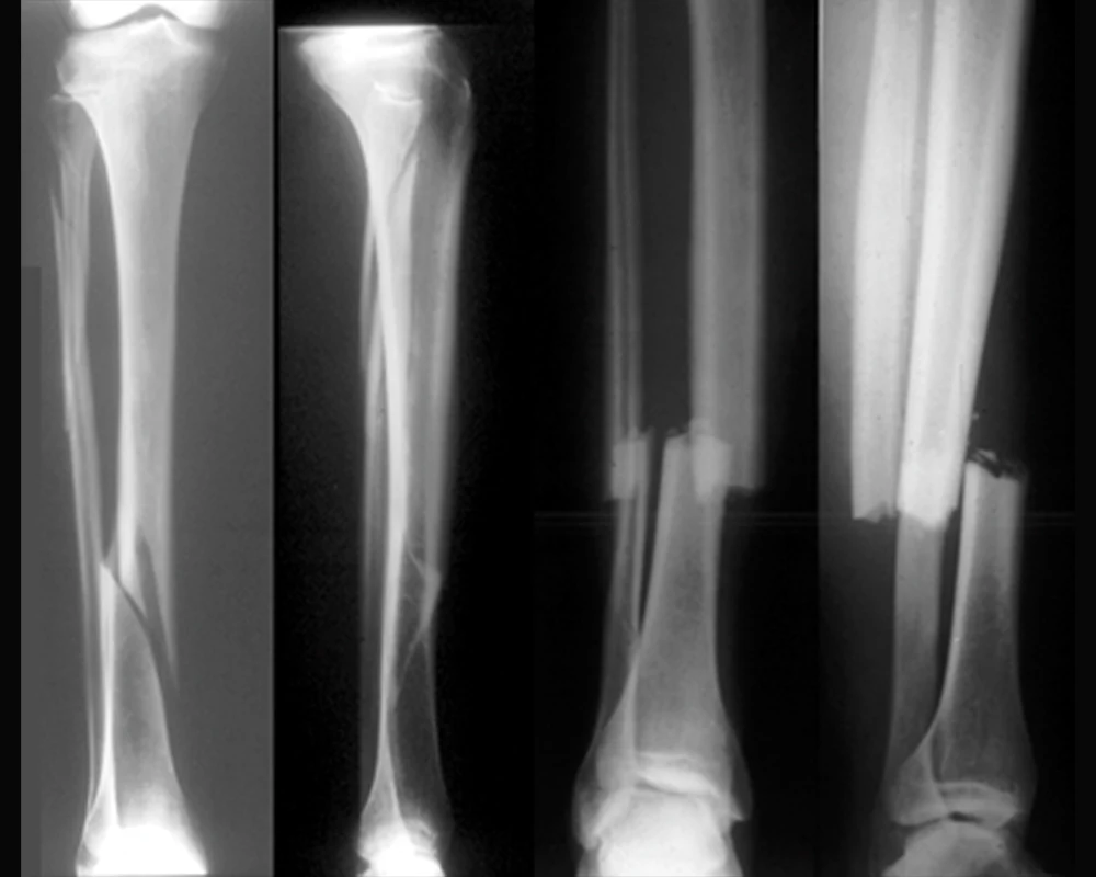 Chirurgie orthopédique