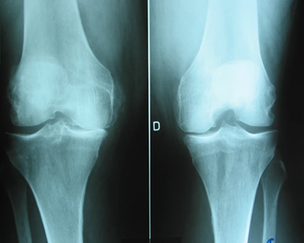 Chirurgie orthopédique