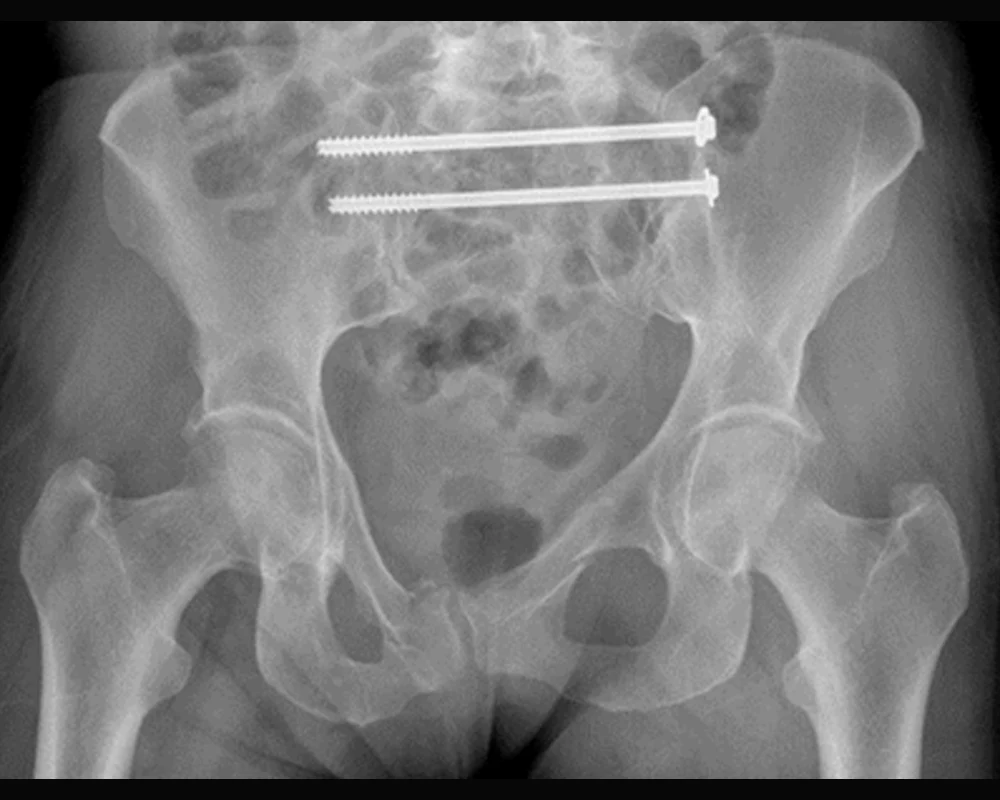 Chirurgie orthopédique