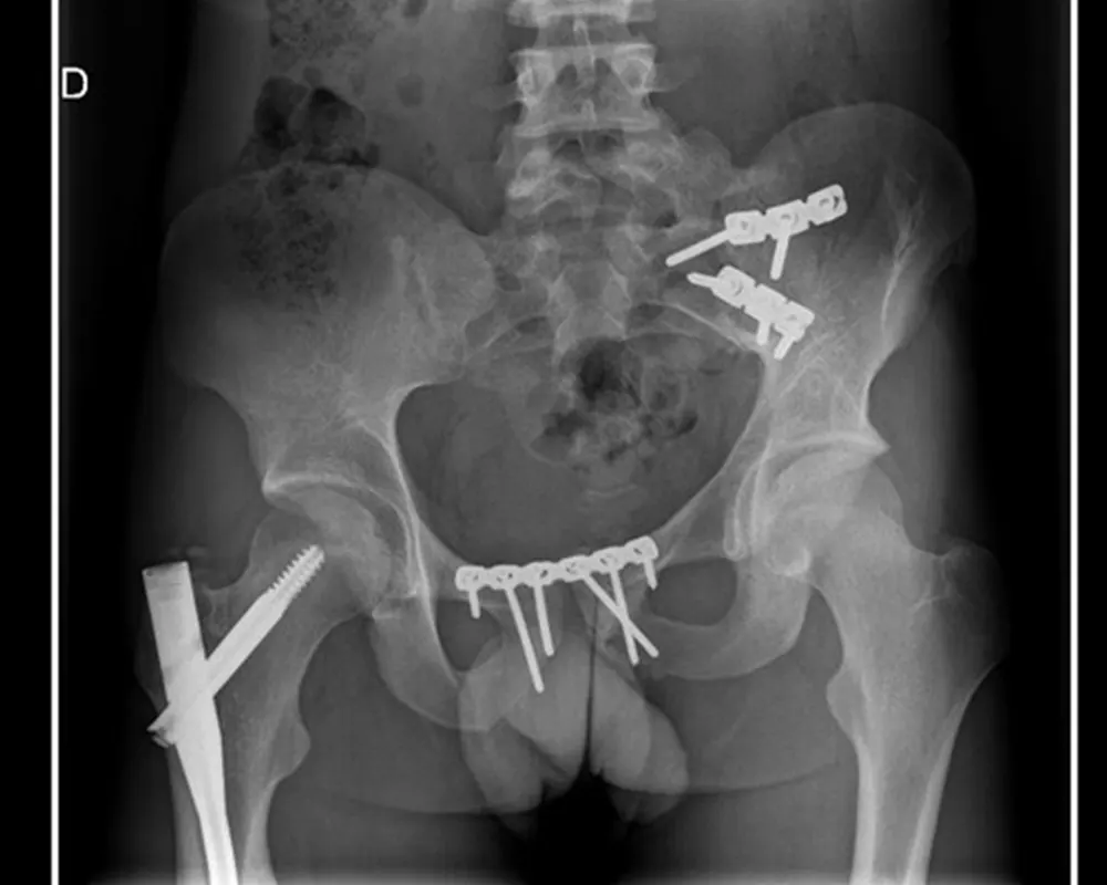 Chirurgie orthopédique