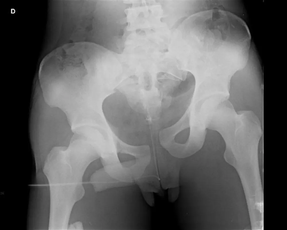 Chirurgie orthopédique