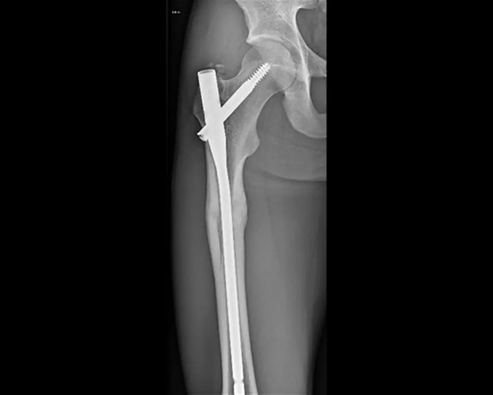 Chirurgie orthopédique