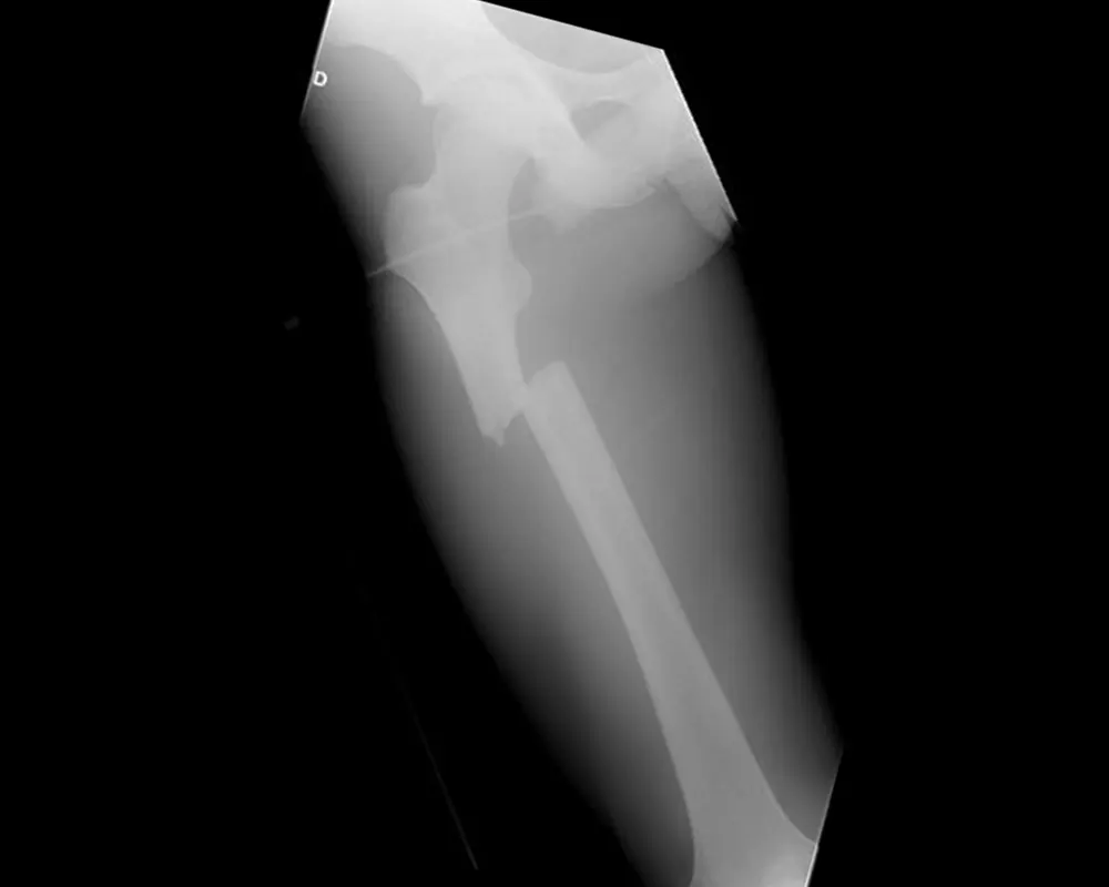 Chirurgie orthopédique