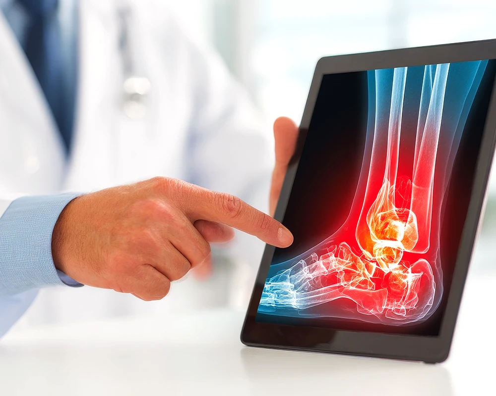 Chirurgie orthopédique